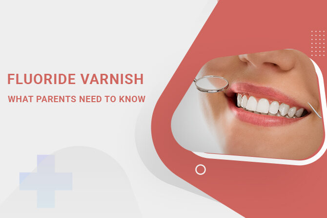 Fluoride Varnish: What Parents Need to Know