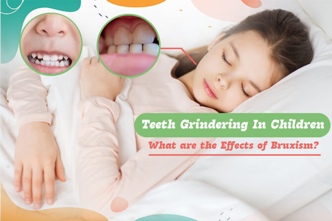 Teeth Grinding in Children: What are the Effects of Bruxism?
