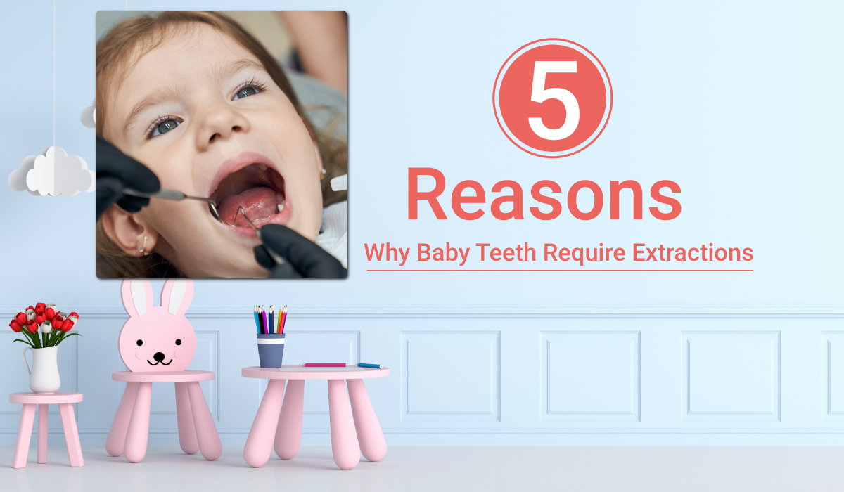 5 Reasons Why Baby Teeth Require Extractions