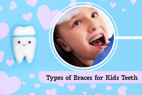 The Different Types of Braces for Kids Teeth
