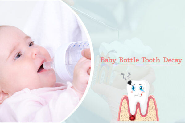 Preventing Baby Bottle Tooth Decay: Tips and Tricks for New Parents