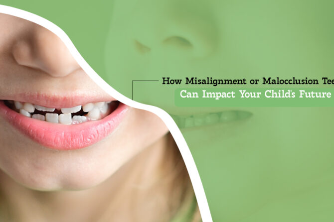 How Misalignment or Malocclusion Teeth Can Impact Your Child’s Future?