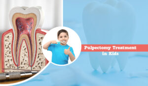 Pulpectomy Treatment in Kids