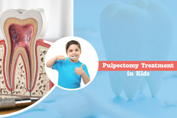 Pulpectomy Treatment in Kids: When and Why It’s Needed