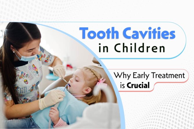 Tooth Cavities in Children: Why Early Treatment is Crucial
