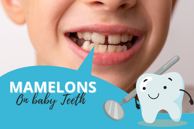 Mamelons On baby Teeth: What Are These & How To Treat Them
