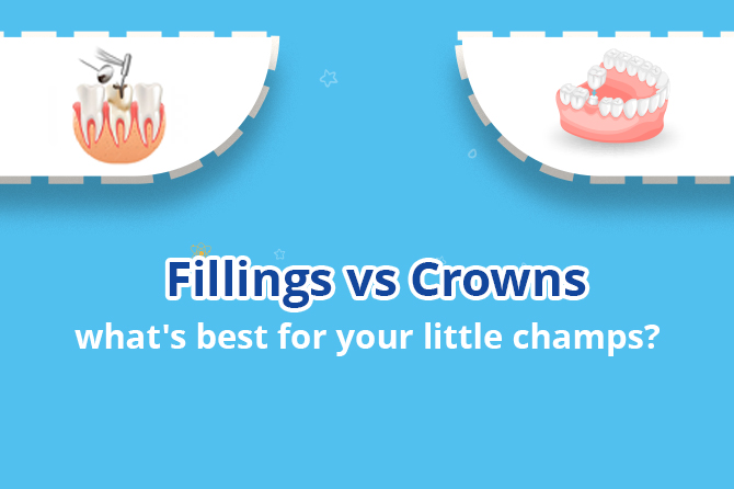 Fillings vs Crowns Wondering What’s Best for Your Little Champs?