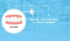 How Can I Tell If My Child or I Have a Crossbite?