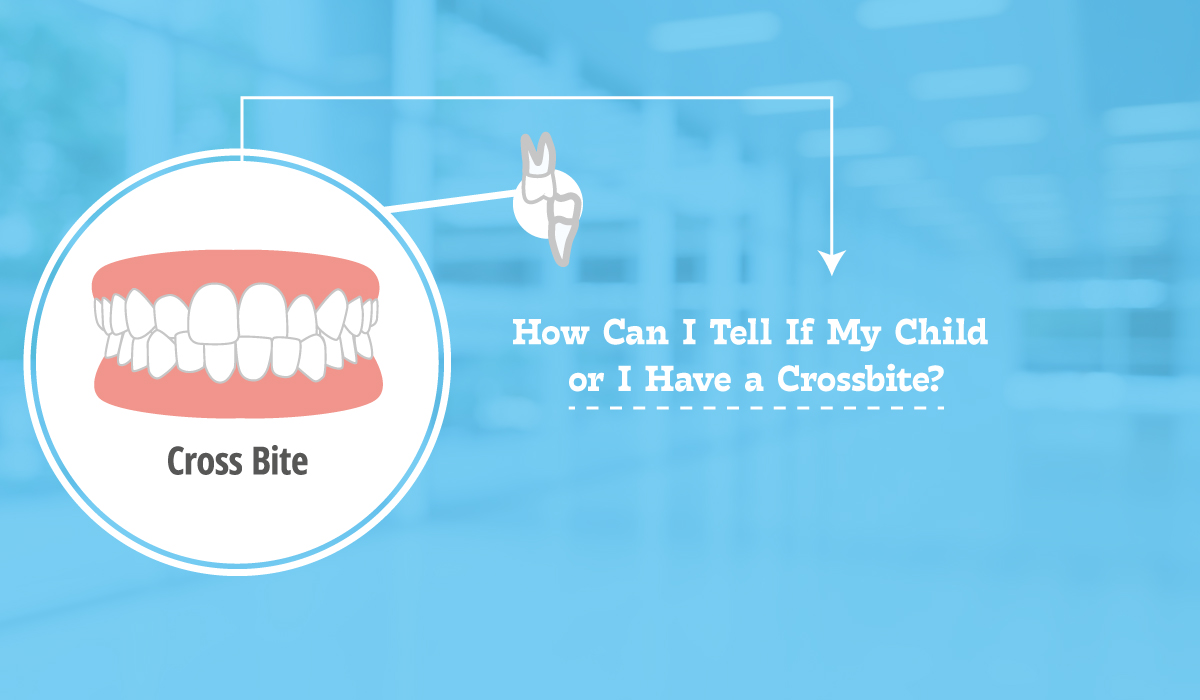 How Can I Tell If My Child or I Have a Crossbite? Kids Dental Studio