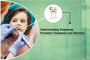 Pulpotomy Procedure Treatment-Kids Dental Studion