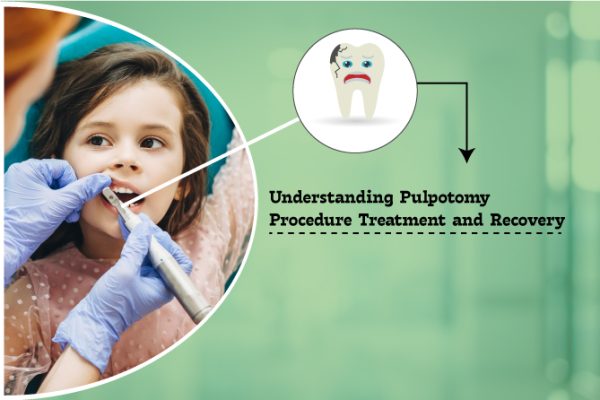 Understanding Pulpotomy Procedure Treatment and Recovery