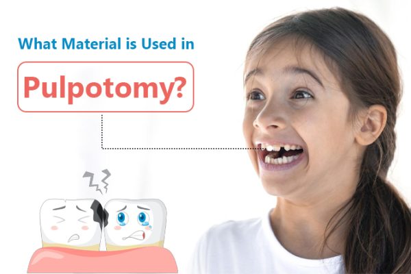 What Material is Used in Pulpotomy?