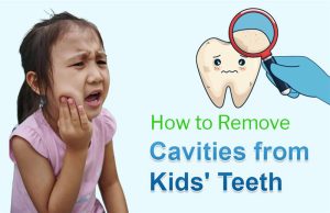 Tips to remove cavities from kids teeth