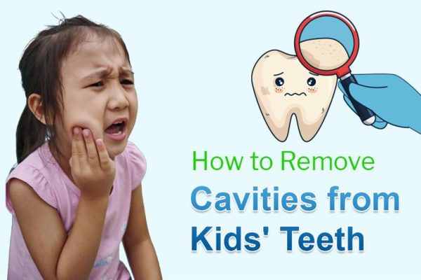 How to Remove Cavities from Kids Teeth