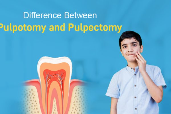 Difference Between Pulpotomy and Pulpectomy