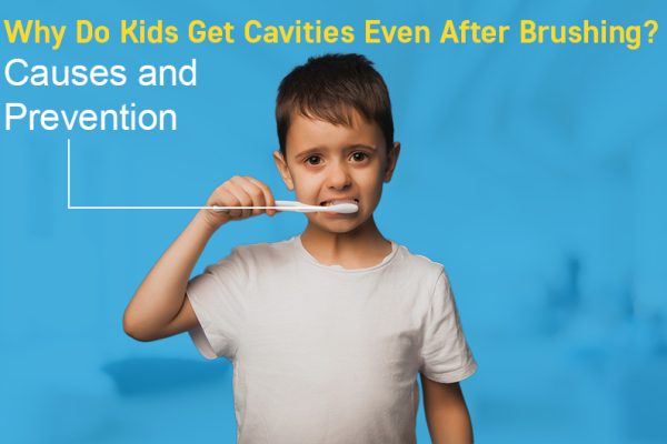 Why Do Kids Get Cavities Even After Brushing? Causes and Prevention