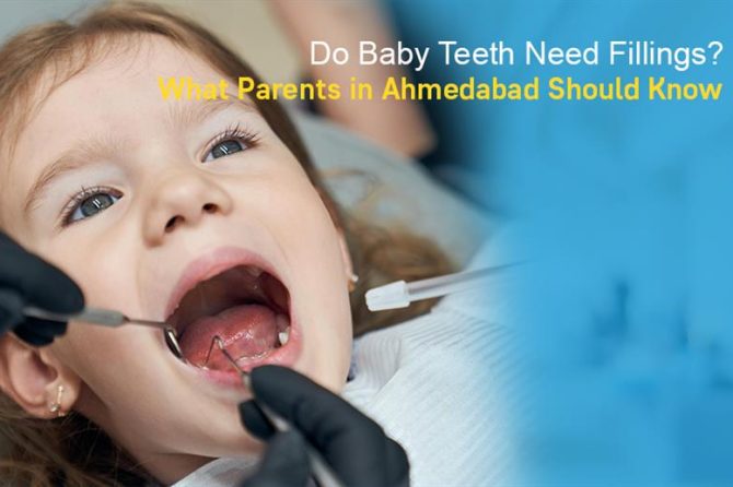 Do Baby Teeth Need Fillings? What Parents in Ahmedabad Should Know