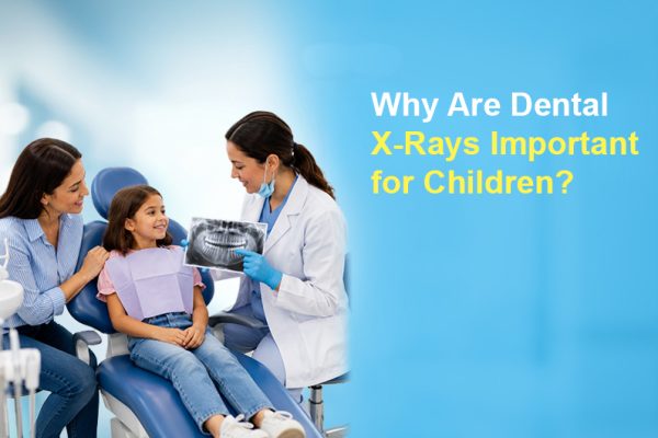 Why Are Dental X-Rays Important for Children?