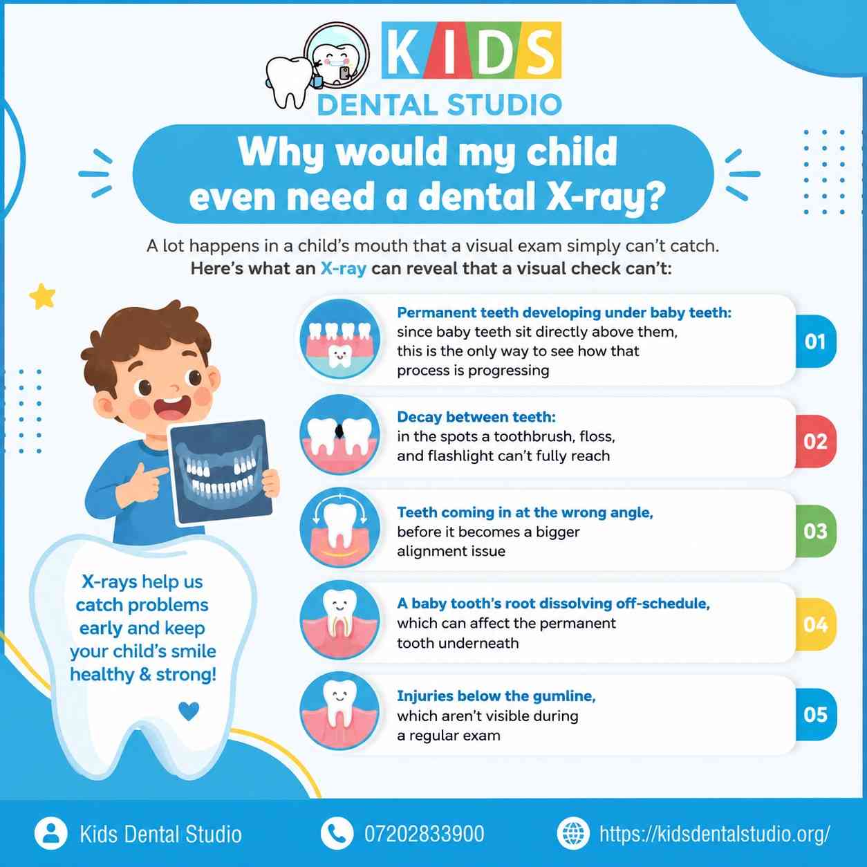 Dental X-Rays Safe for Childre