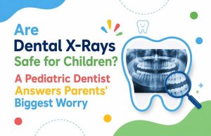 Dental X-Rays Safe for Children