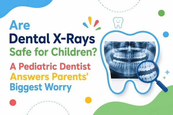 Are Dental X-Rays Safe for Children? A Pediatric Dentist Answers Parents’ Biggest Worry