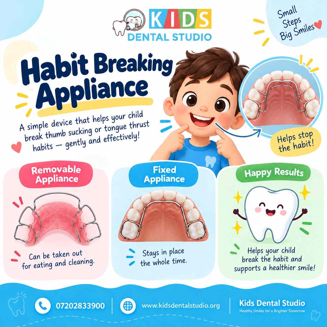 Habit breaking appliance