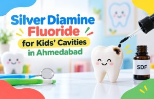 Silver Diamine Fluoride for Kids