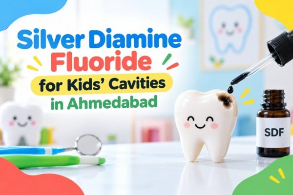 Silver Diamine Fluoride for Kids: A Filling-Free Way to Stop Cavities